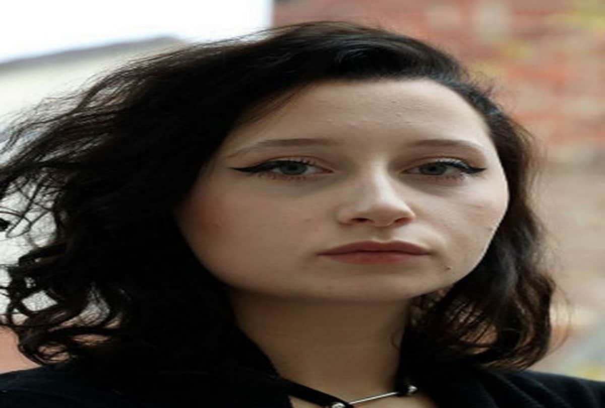 viral story france girl do hair dye which result allergic to her and head size becomes double