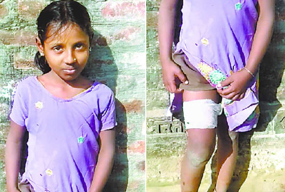 leopard attacked on a 12 years girl in bahraich