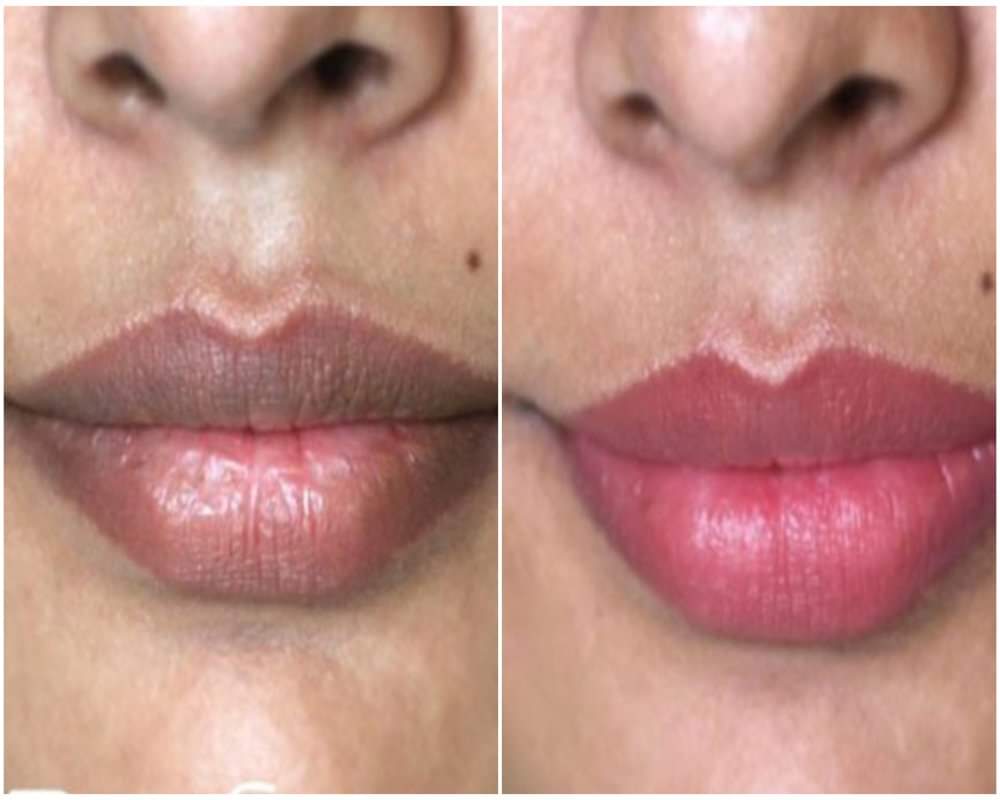 Tips to turn your black lips into soft and pink colour naturally