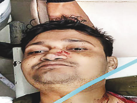GRP sub inspector shot himself in Jalon, admitted to hospital