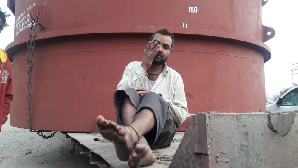a driver burnt by hightension crrent
