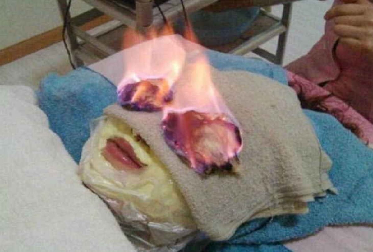 Fire Therapy is The Hottest beauty trend in Vietnam Viral Video