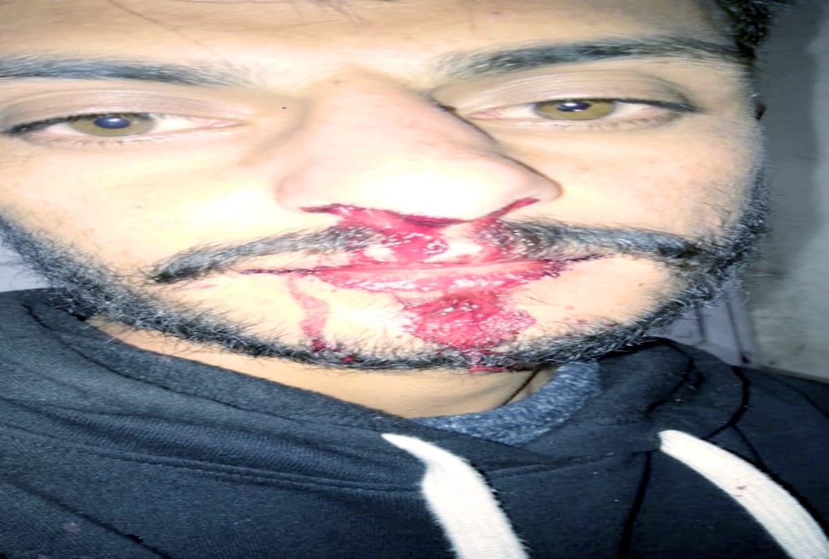 Teachers beaten up student in sanjauli college shimla