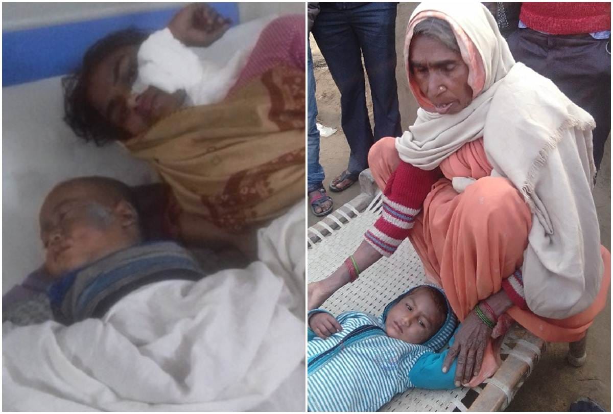 Acid thrown on women and children to trap brother in Bareilly
