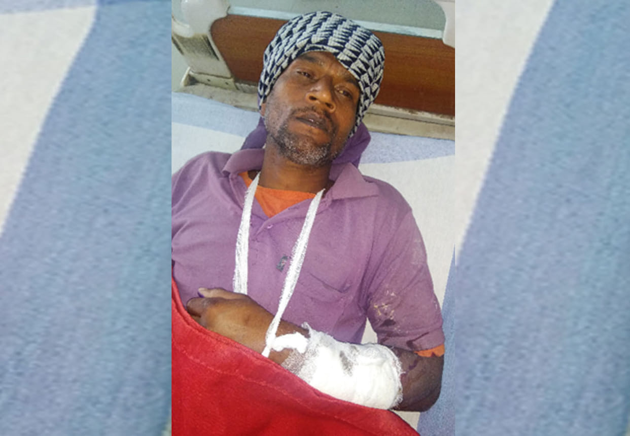 prisoner wounded during pleaching Flour in jail