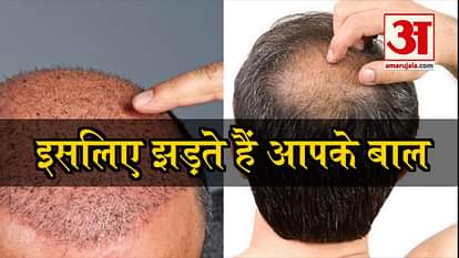 These are 6 reasons for men's hair loss, such as prevention
