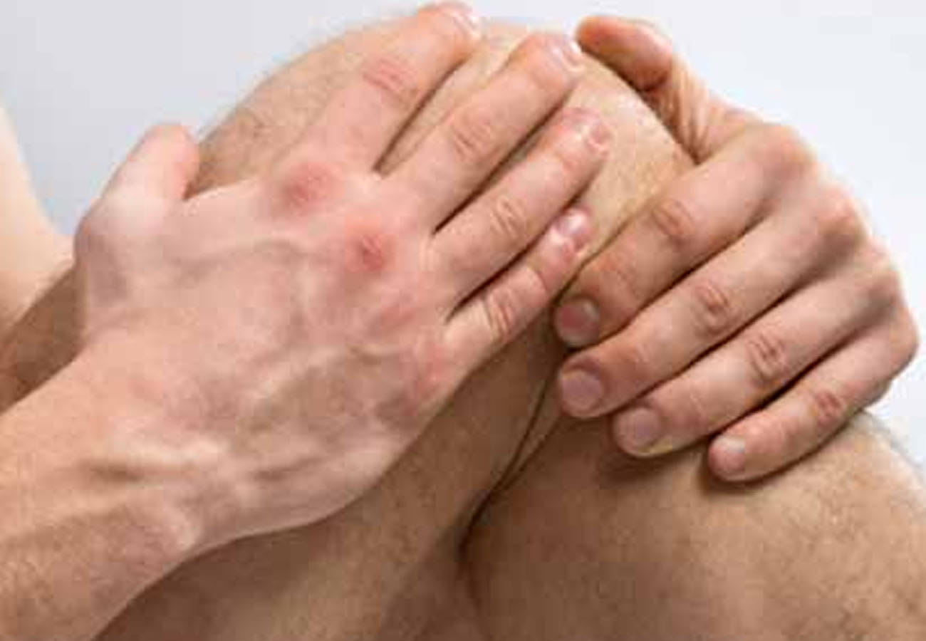 Tips to Avoid Cold Soreness