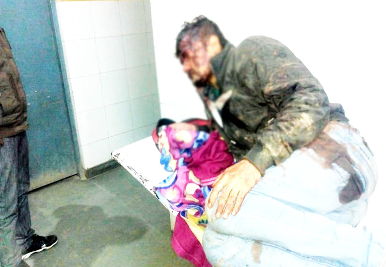 road accident on expressway in unnao