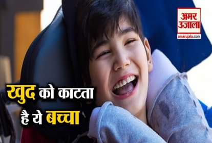 viral videos this 11 year old kid has a disease to eat himself