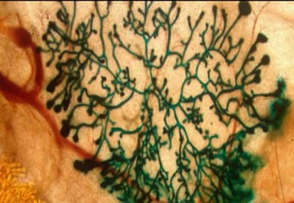 Stem cells made of bone will gave you speed in life