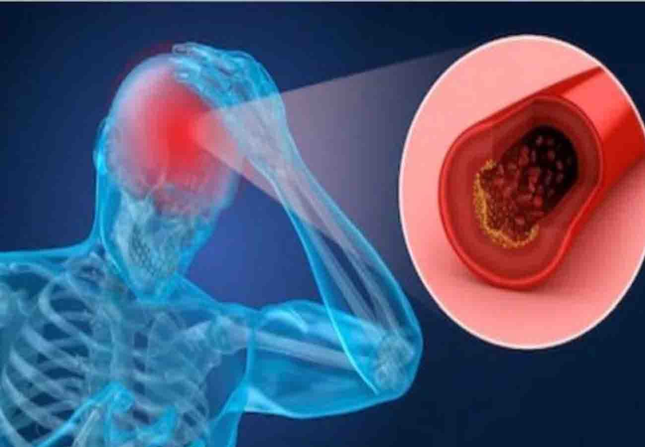 Danger of cold rising heart attack and brain attack