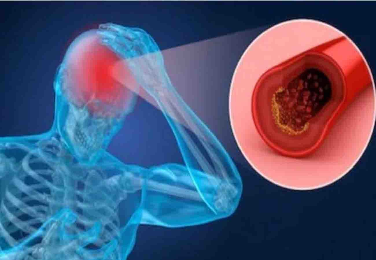 increased cases of heart attack and brain stroke in winter season