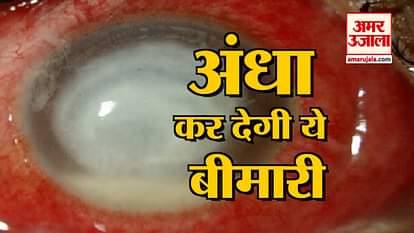 Due to these diseases people are cataract victims