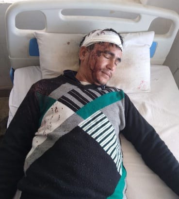 Contractor's men attacked fierce assault