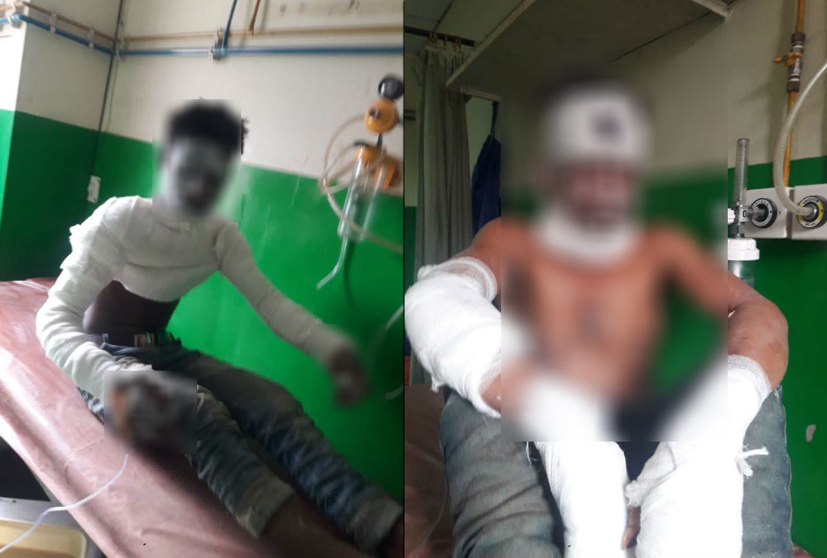 four workers injured in boiler blast of factory in mathura