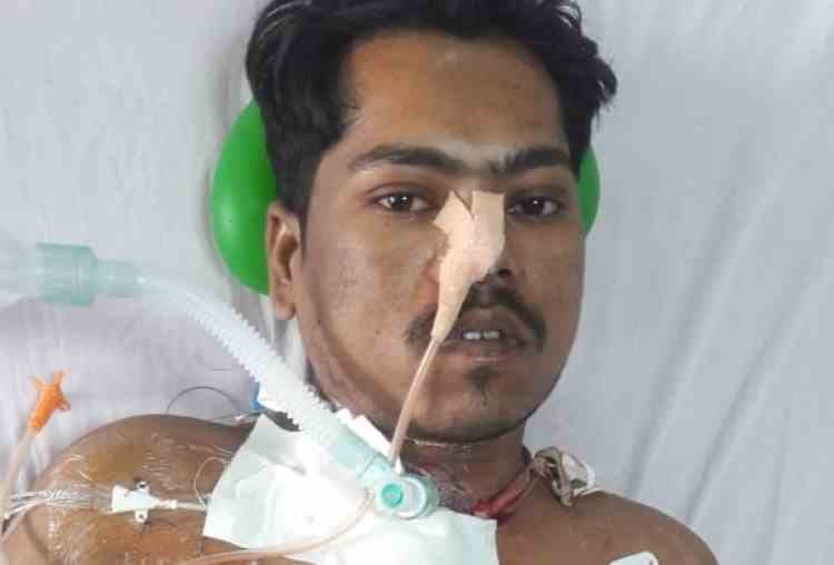 doctors of KGMU gave a new life to patient