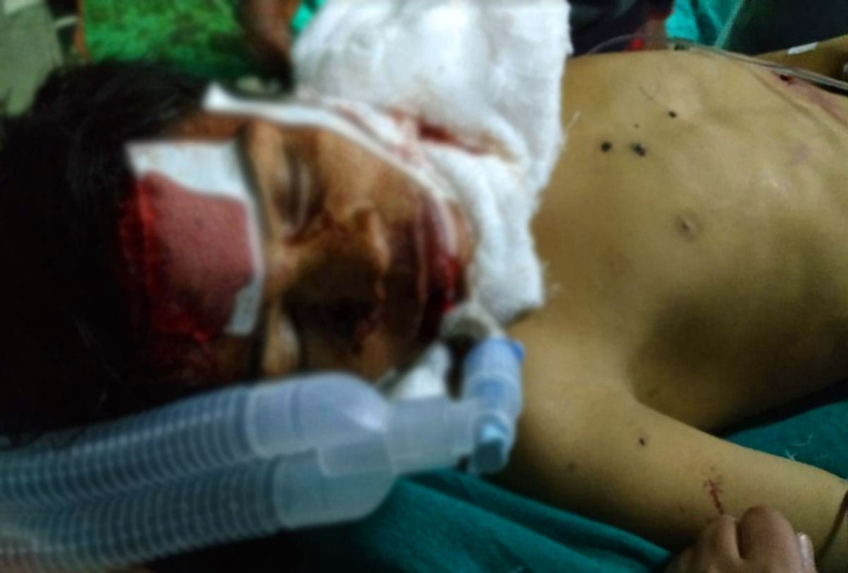jammu kashmir pulwama 10 year old boy explored grenade in his hand while playing with it, dead