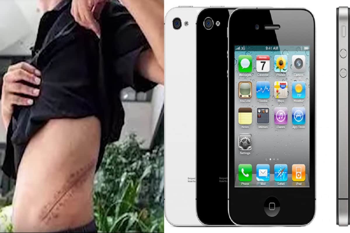17 year old boy sold his kidney for an iPhone 4, now is bed-ridden for life