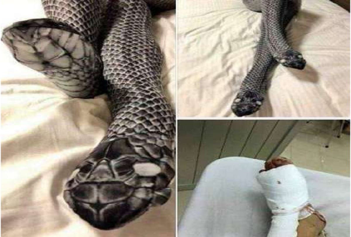 woman wears stockings looking like snake husband understood two snakes and beats her