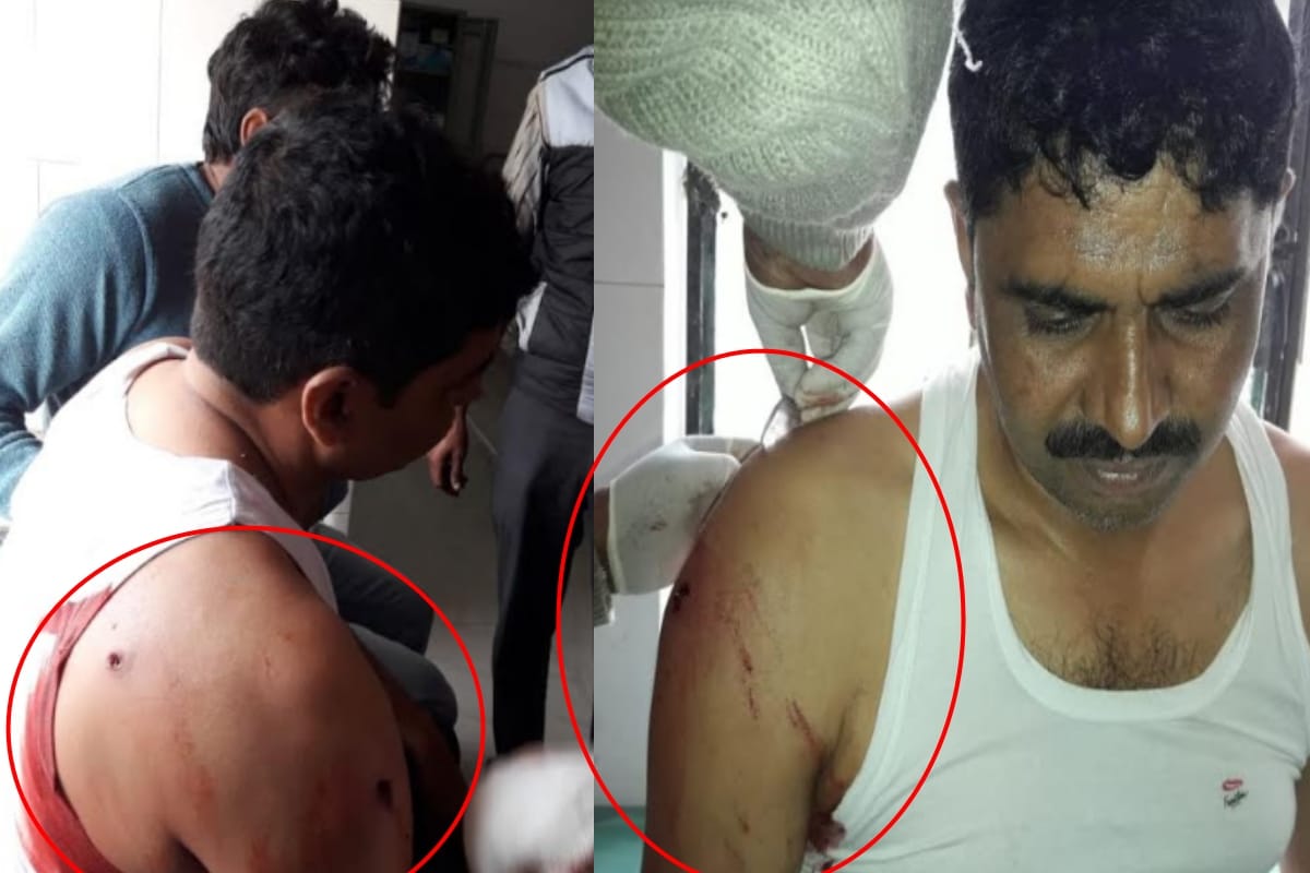 Bagpatt: one injured after Fierce firing between two sides related to mutual rigging