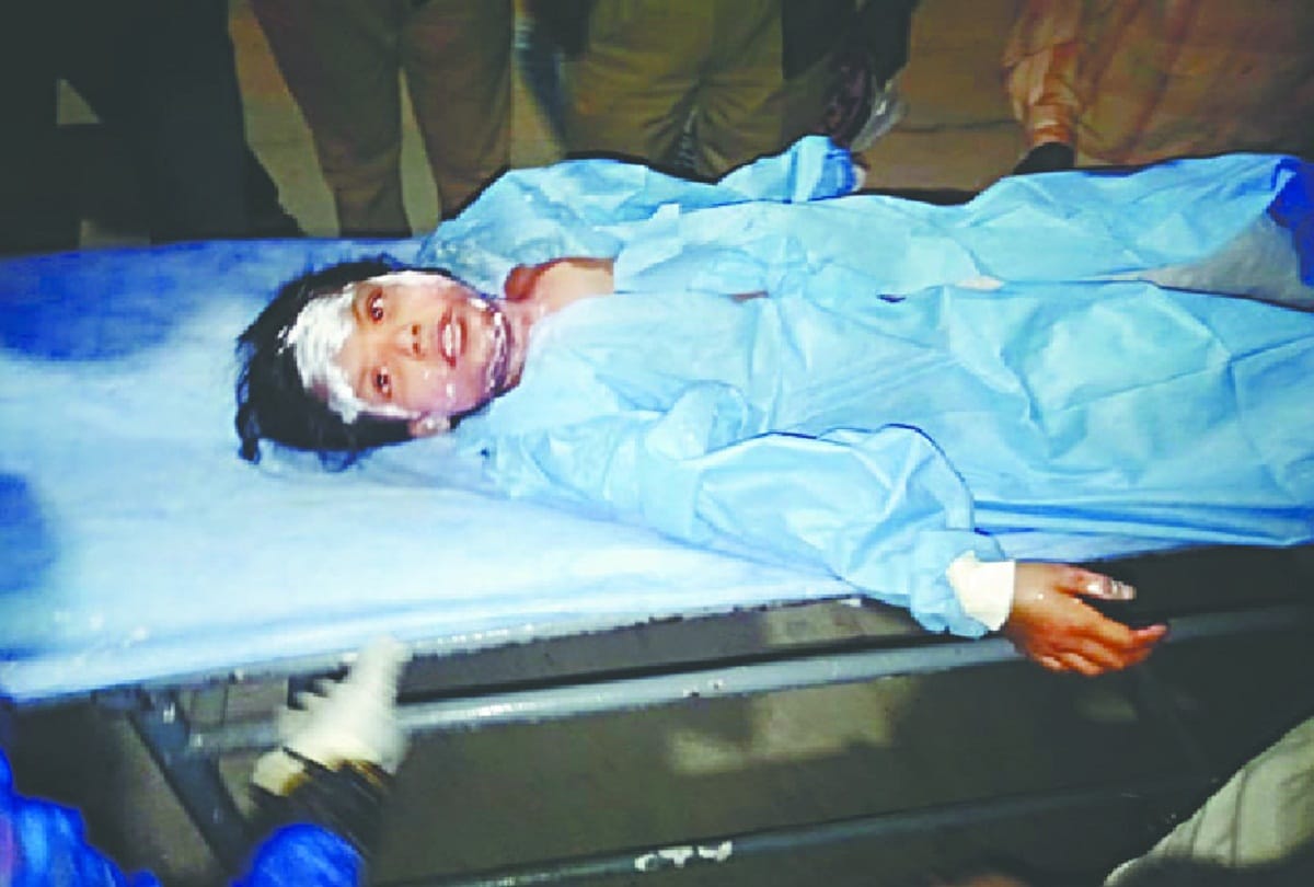 four children Burn in delhi
