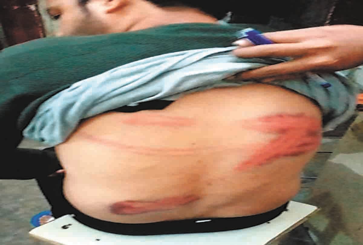 FIR in the case of beating in Deoria Jail ateeq ahamad