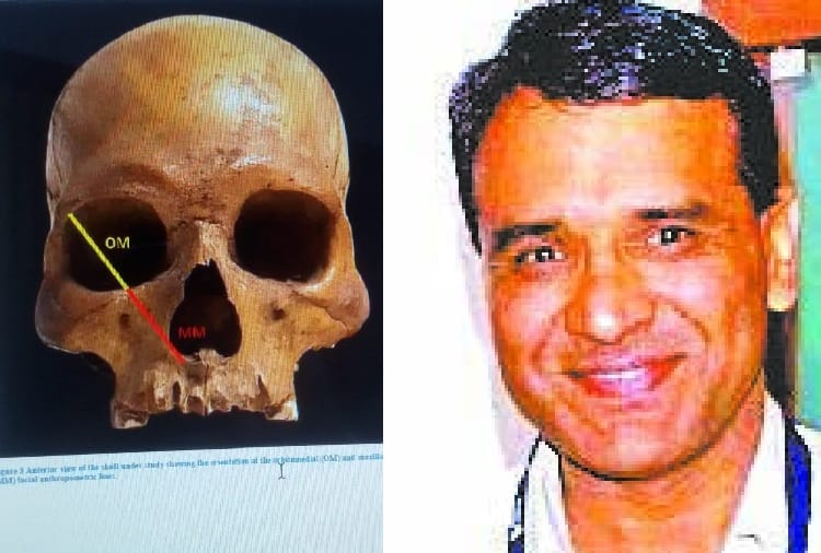 Freedom Fighter Sepoy Alam Beg Skull found in England, Indian Rebellion of 1857