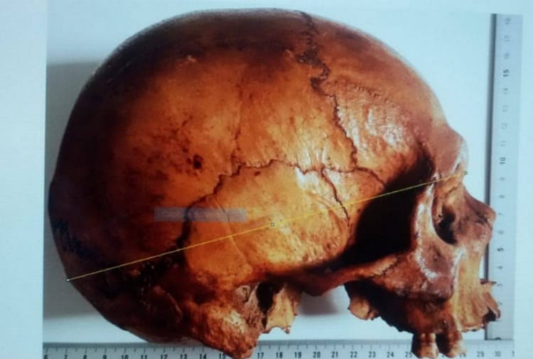 Freedom Fighter Sepoy Alam Beg Skull found in England, Indian Rebellion of 1857