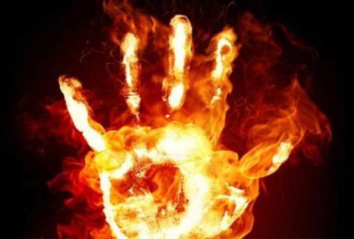 A man set fire himself with his girlfriend.