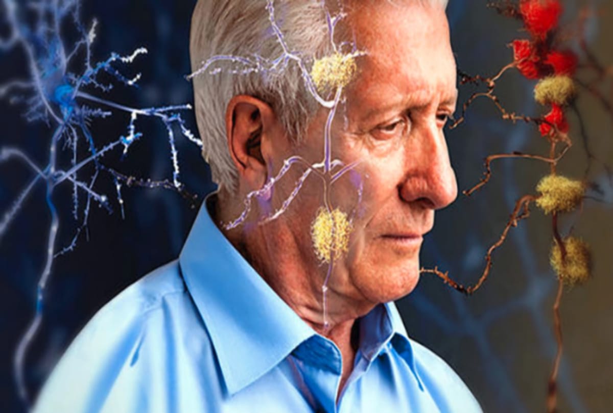 away from alzheimer taking proper sleep is necessary