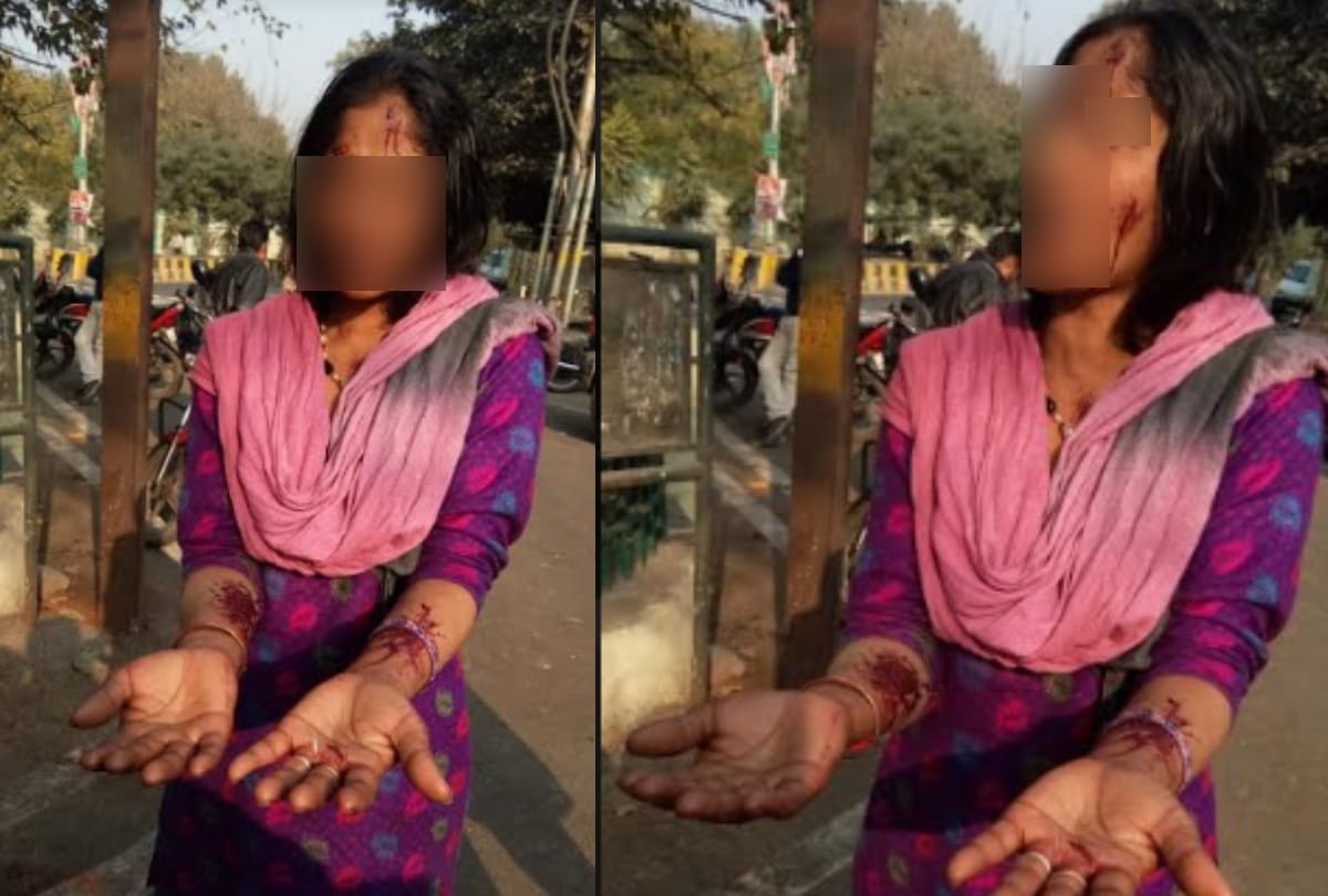 UP: In-laws attack on daughter-in-law , victim seeks justice from SSP meerut