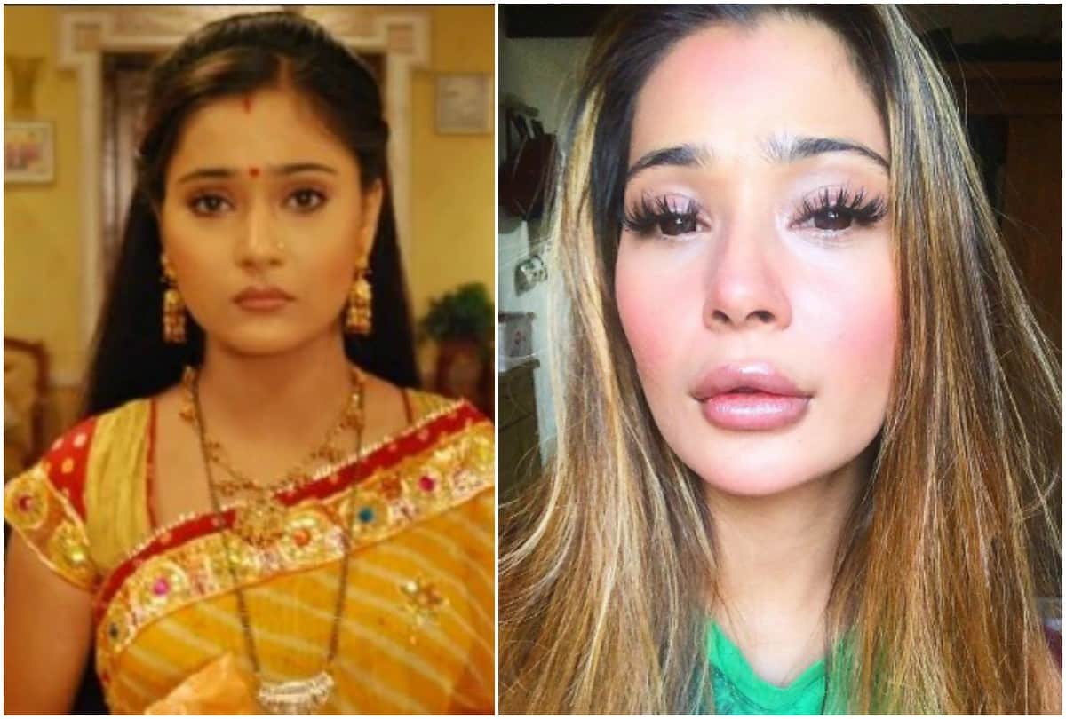 Sara Khan troll on lip surgery picture revealed shocking thing now