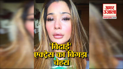 sara khan lip surgery went wrong see video