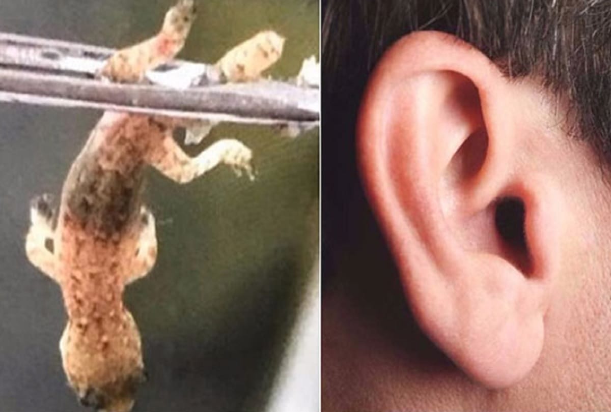 Squirming lizard removed from man’s ear in China beijing 