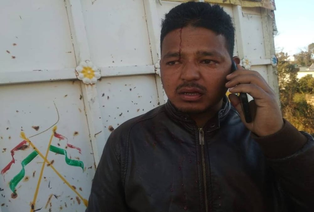 Firing on youth Businessman in his shop nainital