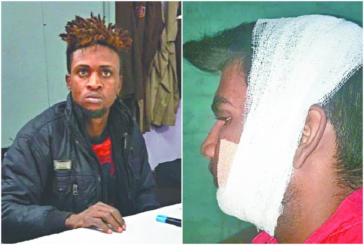 Nigerian cut man cheek in nihal vihar