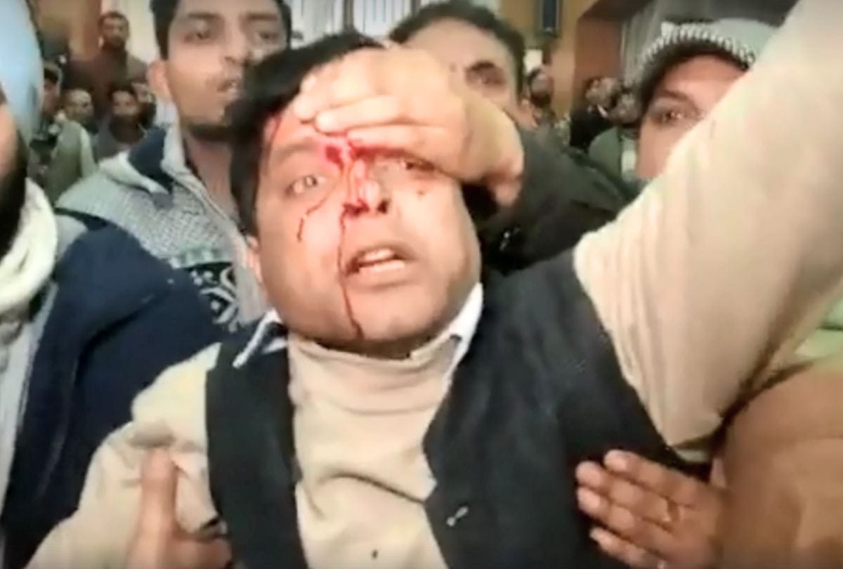 Clash Between Himachal congress supoorters of virbhadra and sukhwinder sukhu in shimla