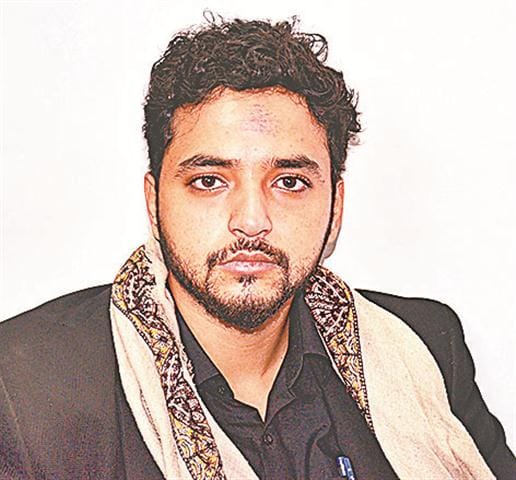 AMU foreign student attacked in Rodez, fiercely beaten
