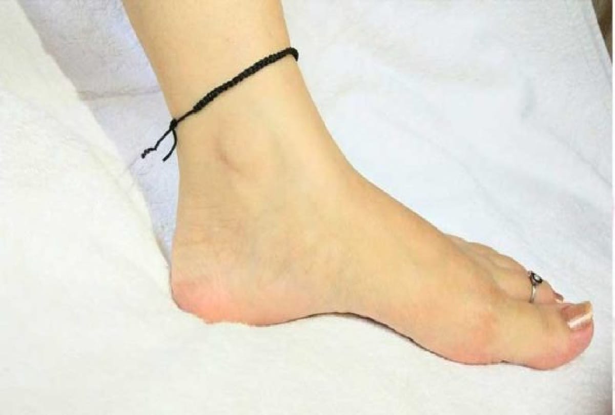 know about Remedy for black thread