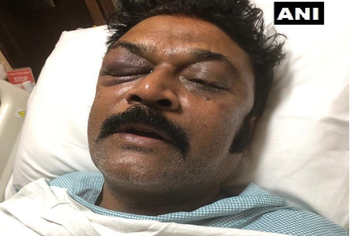 Karnataka Congress MLA JN Ganesh suspended from the party for beating MLA Anand Singh