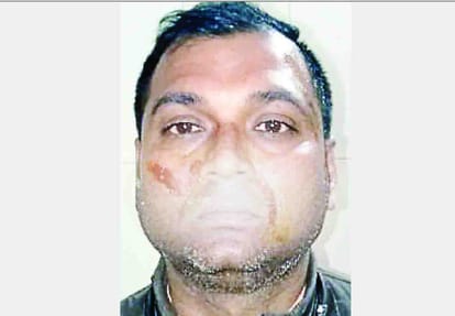 Nurse's husband and youth beat each other