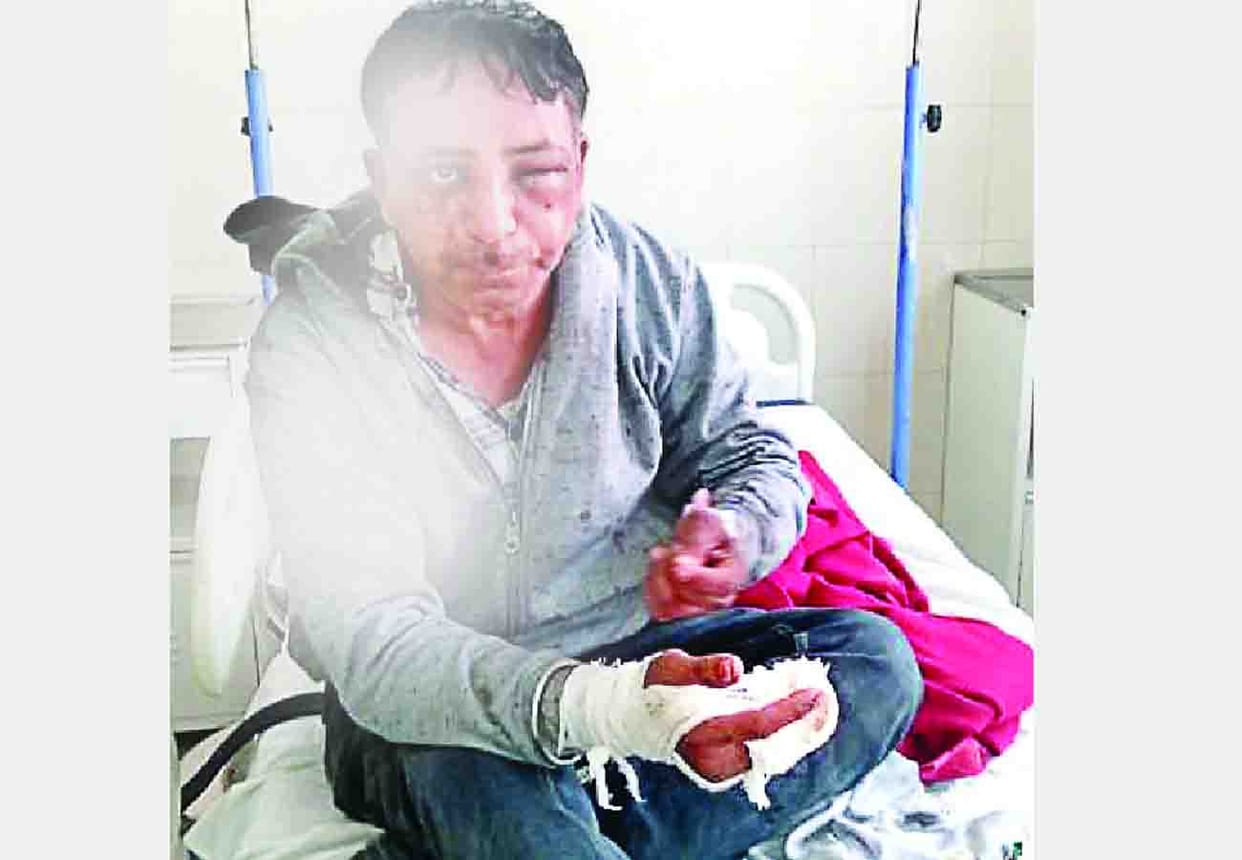 Nurse's husband and youth beat each other