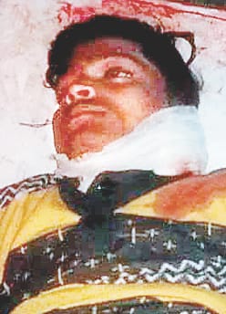 बड़हलगंज में फायरिंग में तीन को गोली लगी