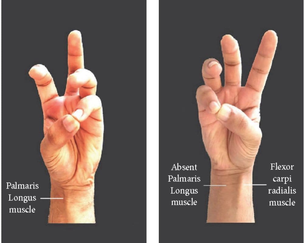 Know about 6 Body Parts that Humans Do Not Need now