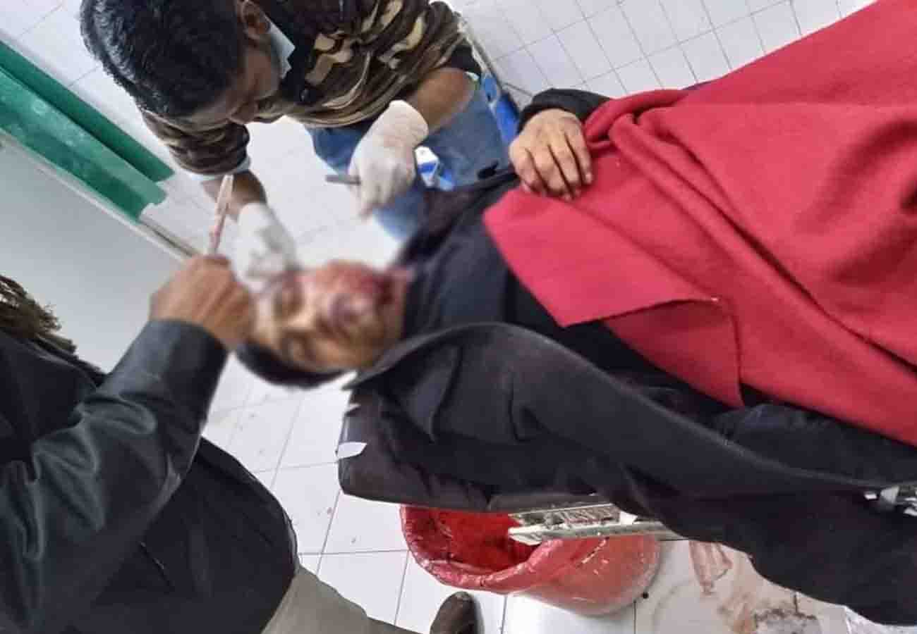 road accident in mahoba, one died and five injured