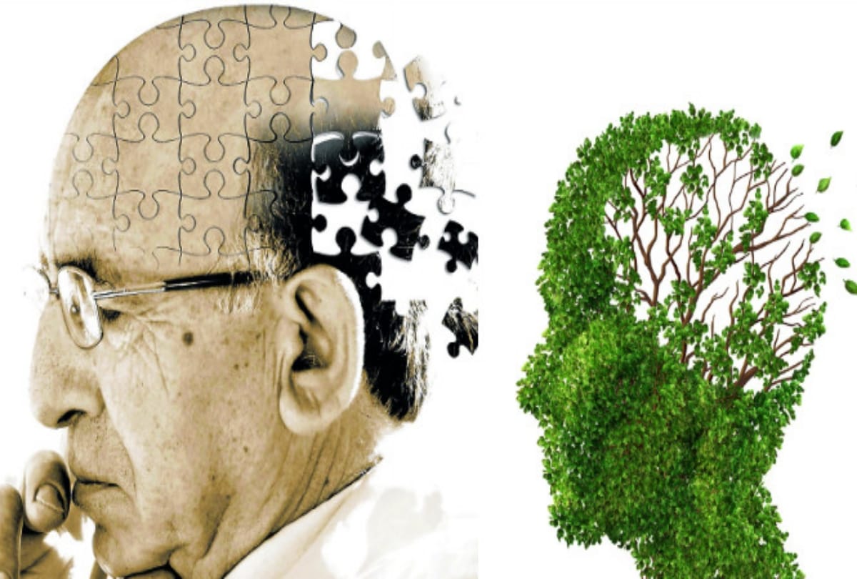 according to research alzheimer effect on gums