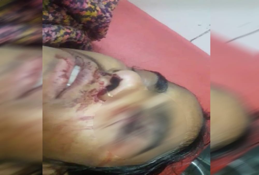 Drunk Husband attack on wife eye by Knife in rudrapur