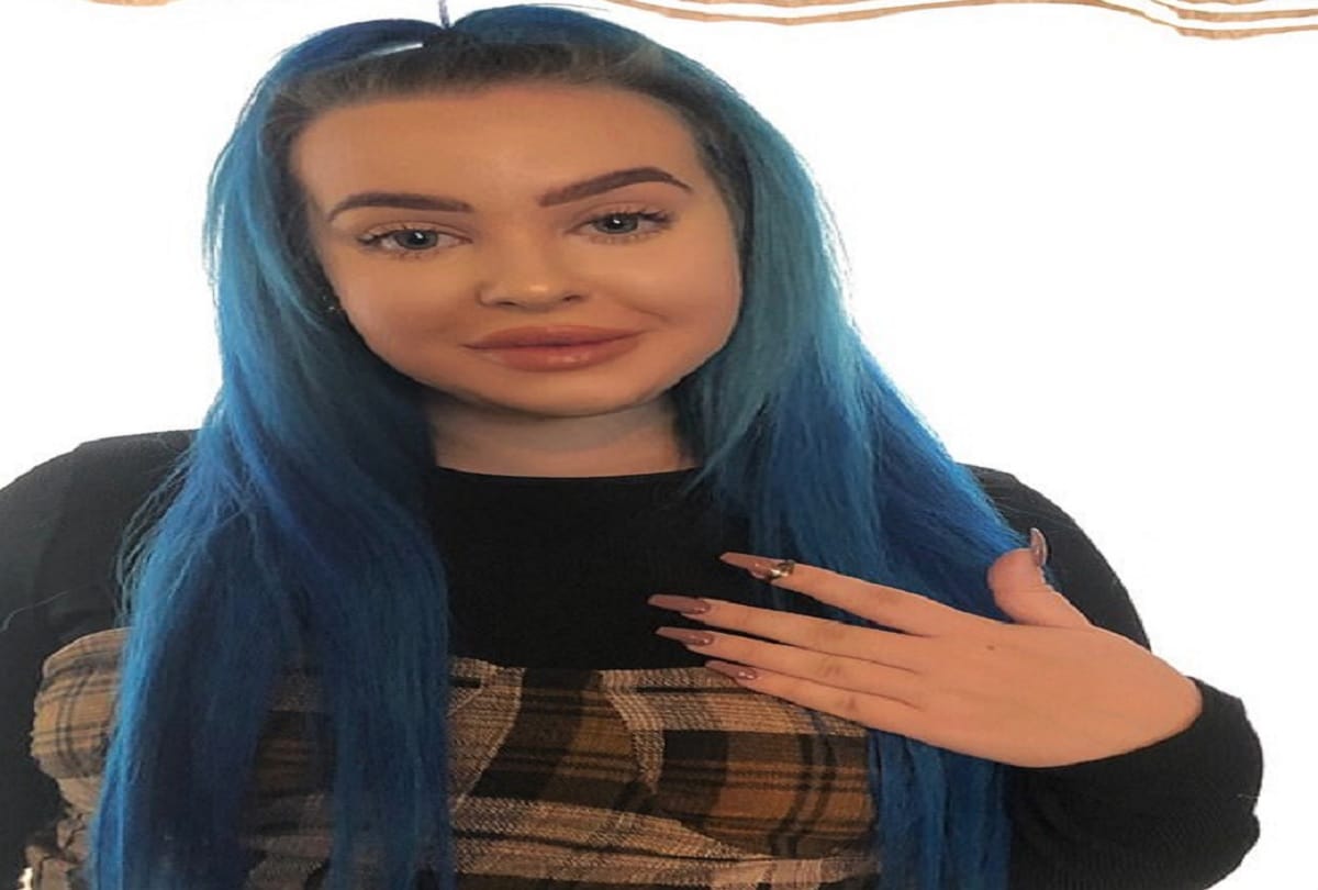 incident this woman sneezed out a ring that has been stuck in her nose for 12 years