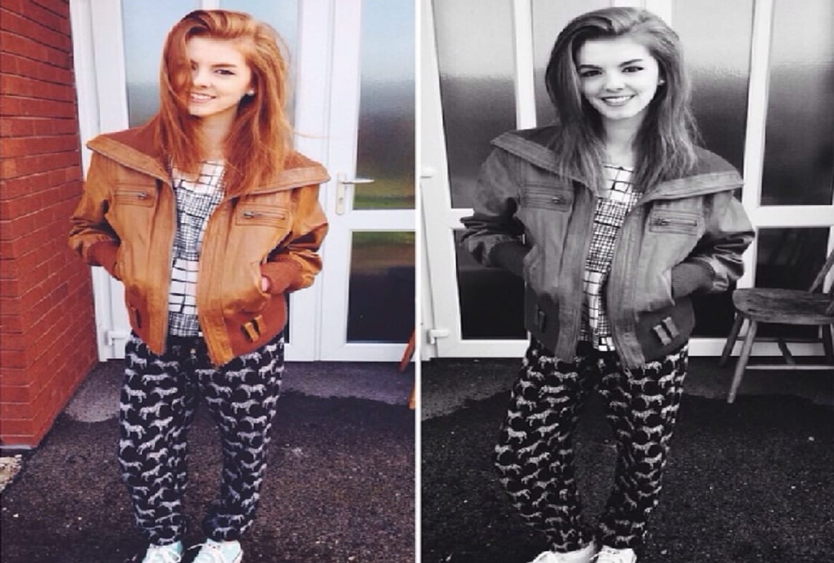 England girl Annie windley body weight was low abnormally because of Anorexia
