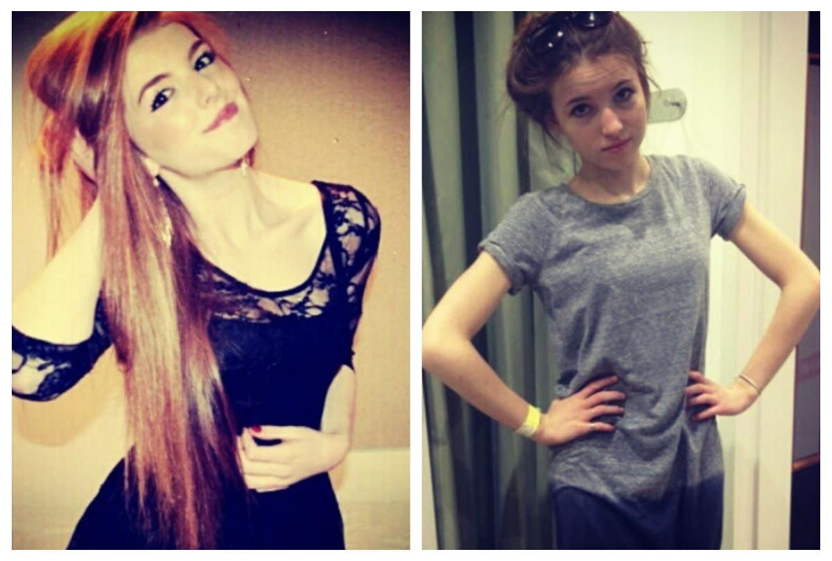 England girl Annie windley body weight was low abnormally because of Anorexia